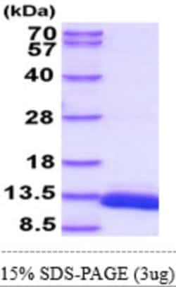 Novus Biologicals&trade;&nbsp;Recombinant Mouse ACBP Isoform 2 Protein